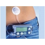Bomba de Infusão de Insulina